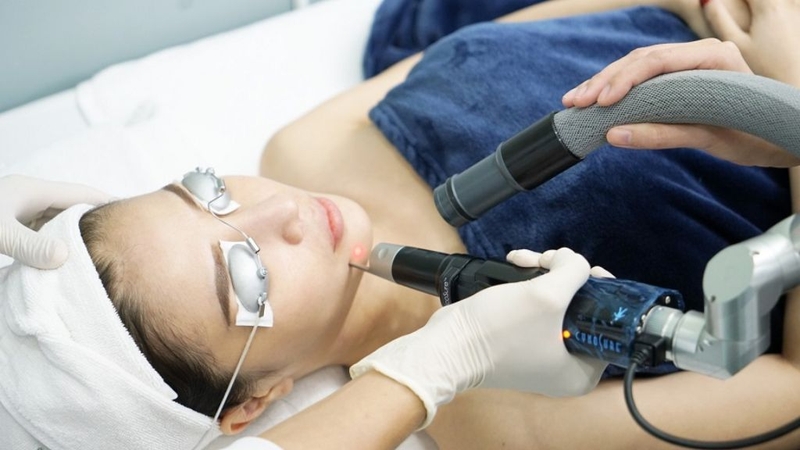 Trị nám bằng Laser Picosure có tốt không? Cần lưu ý điều gì? 2