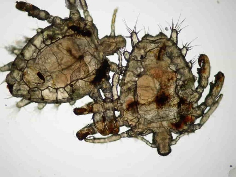 Trị rận mu bằng xà phòng có hiệu quả không 1