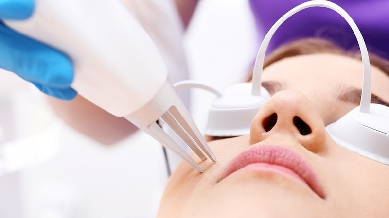 Trị sẹo rỗ có đau không? Các phương pháp điều trị hiệu quả 1