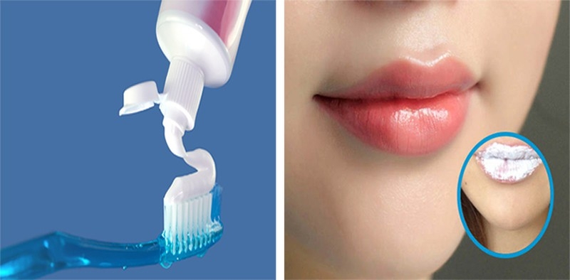 Bí quyết trị thâm môi hiệu quả từ kem đánh răng.