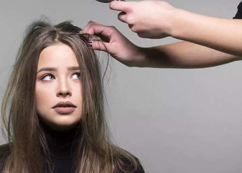 Trị tóc gàu đơn giản không tốn thời gian tại nhà