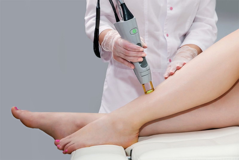 Trị viêm nang lông bằng laser là gì?