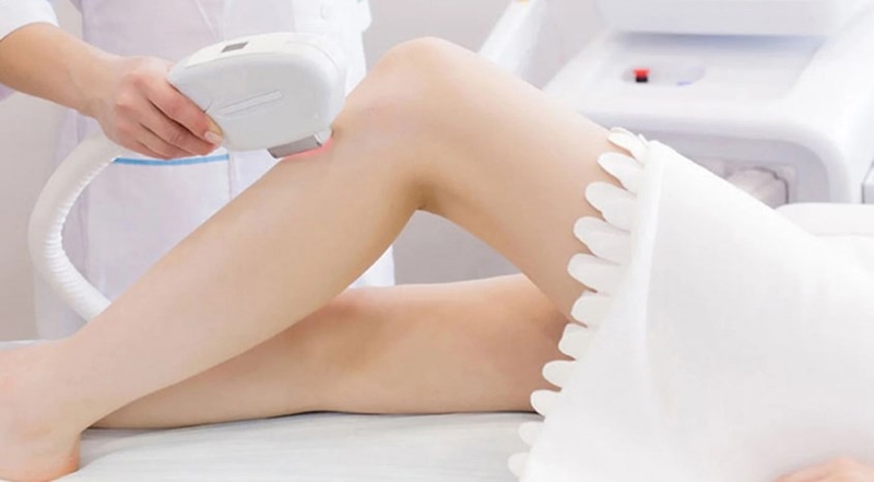 Triệt lông 1/2 chân là gì? Một số phương pháp triệt lông phổ biến hiện nay 4