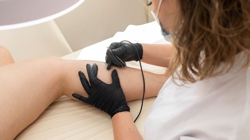 Triệt lông điện phân là gì? Phương pháp triệt lông hiệu quả và lâu dài 1