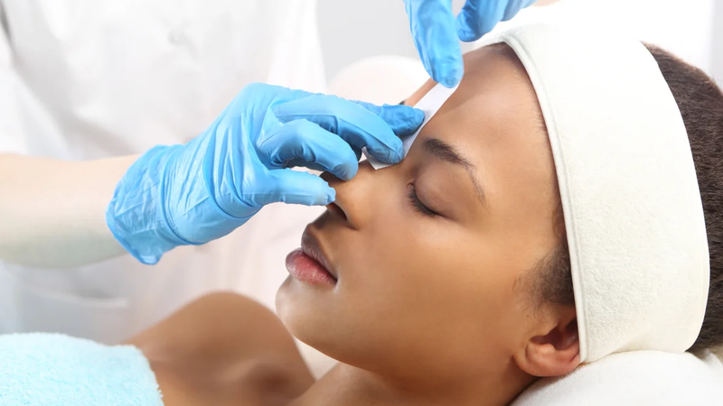 Ưu, nhược điểm phương pháp triệt tóc trán 2