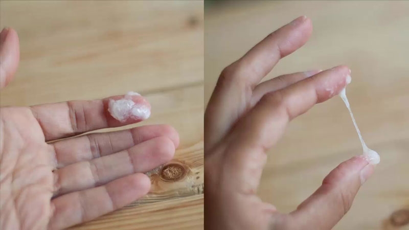 Triệu chứng bệnh lậu ở nữ giới bao gồm những gì?  2