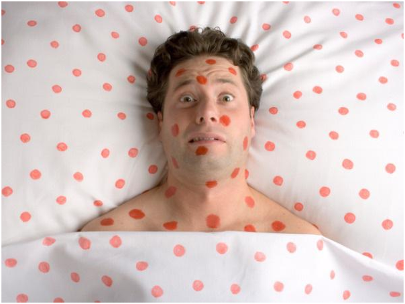 Tìm hiểu các triệu chứng bệnh sởi ở người lớn 1