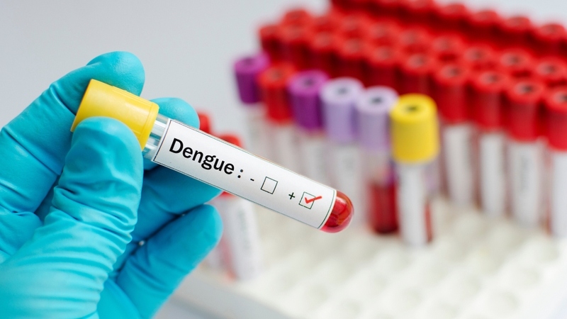 Triệu chứng bệnh sốt xuất huyết ở người lớn từ nhẹ đến nặng 4