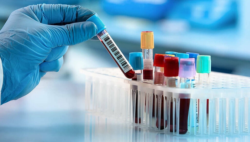 Triệu chứng, chẩn đoán và hướng điều trị hội chứng Loeffler 3