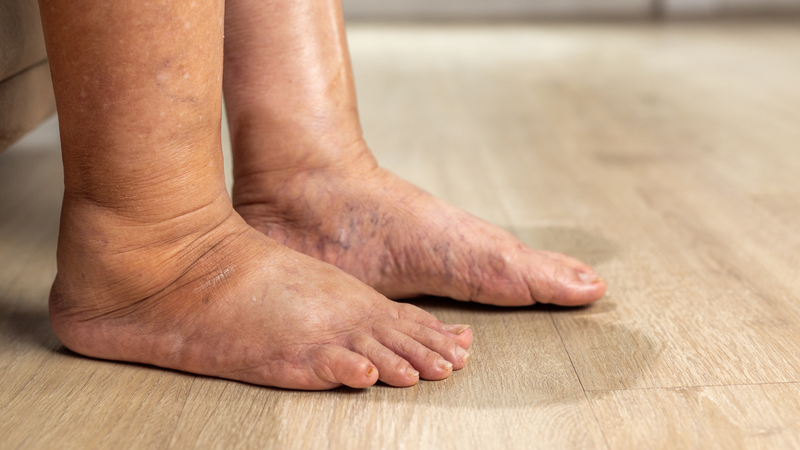 Dấu hiệu da cảnh báo tình trạng thận yếu bạn không thể bỏ qua