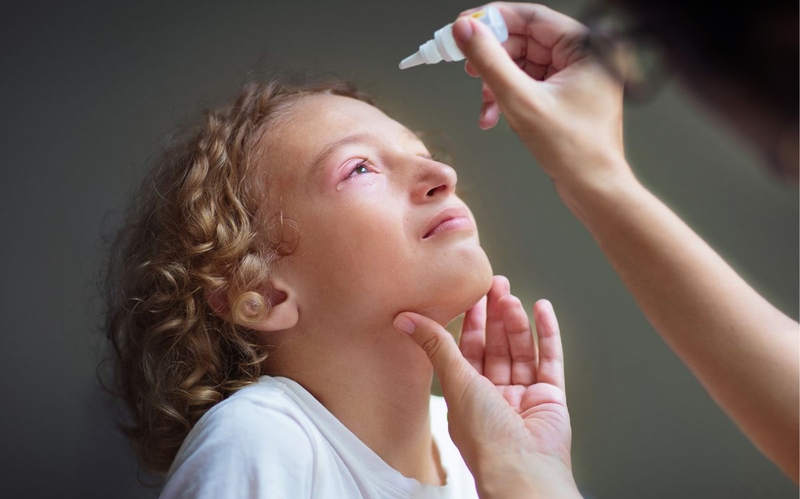 Triệu chứng đau mắt đỏ ở trẻ em nhận biết càng sớm càng tốt 3