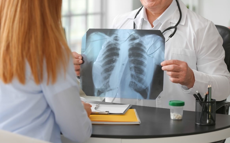 Triệu chứng lao phổi ở người lớn: 6 dấu hiệu cảnh báo không thể bỏ qua 3