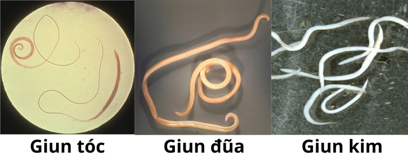 Một số triệu chứng sau khi uống thuốc xổ giun 2