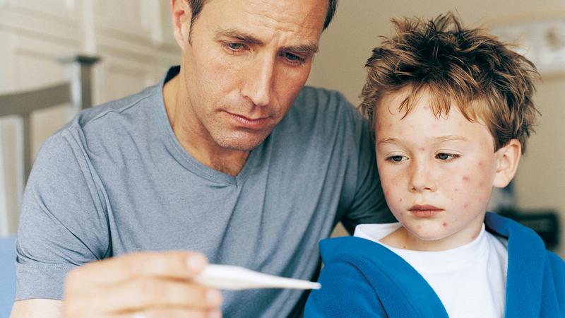 Triệu chứng sốt thủy đậu: Cách nhận biết và phòng ngừa 2