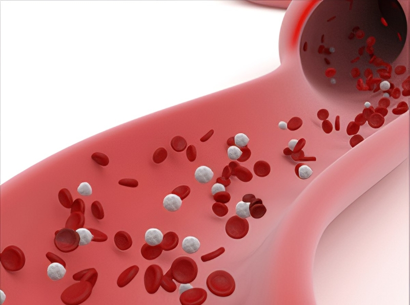 Triệu chứng tăng canxi máu trong ung thư1