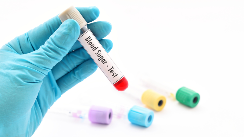Xét nghiệm đường huyết là tiêu chuẩn chẩn đoán bệnh tiểu đường