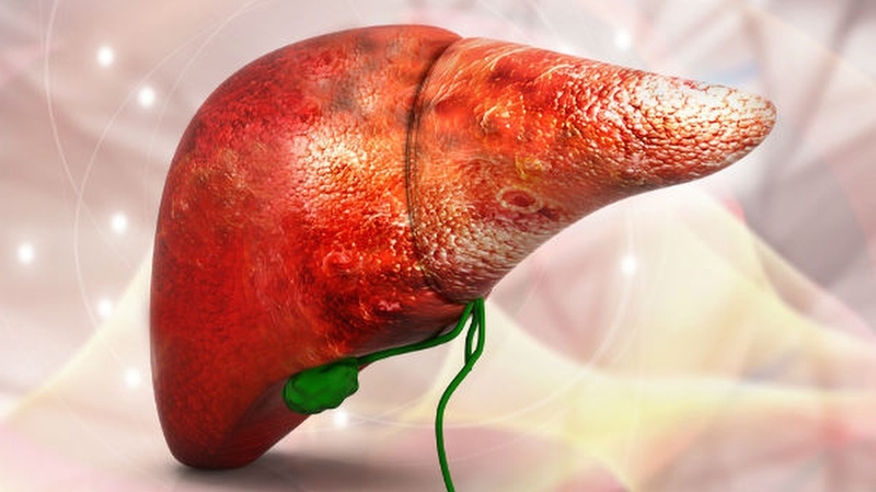 Triệu chứng ung thư gan giai đoạn cuối: Dấu hiệu nhận biết và cách đối phó 1