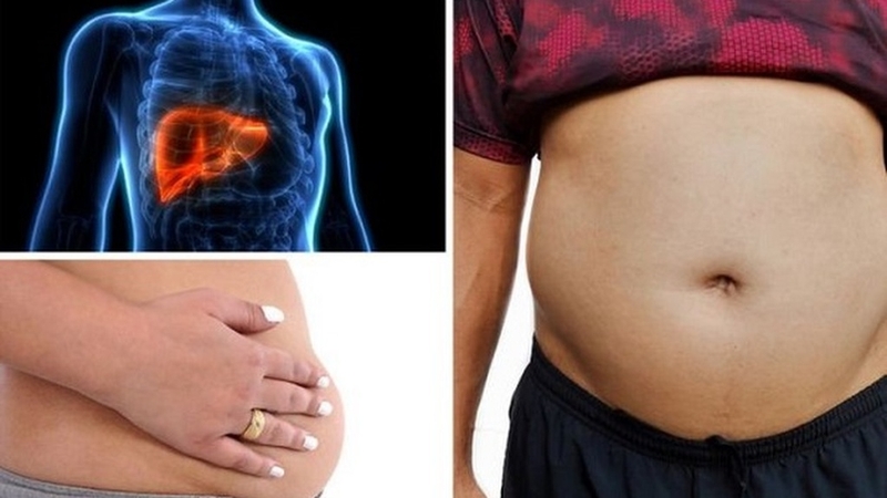 Triệu chứng ung thư gan giai đoạn cuối: Dấu hiệu nhận biết và cách đối phó 2