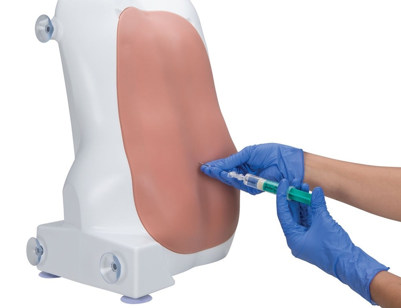 Triệu chứng và chẩn đoán u màng não thất ở trẻ em 3