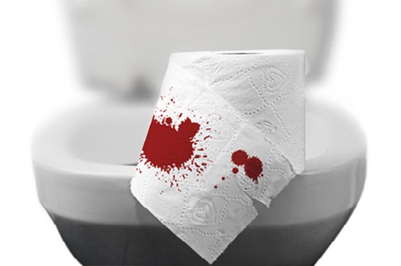 Triệu chứng viêm đại tràng ra máu khi đi ngoài có nguy hiểm không 1