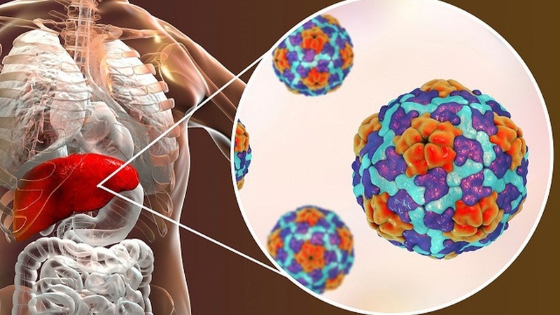 Bệnh viêm gan B có triệu chứng gì? Phòng bệnh như thế nào hiệu quả nhất? 1