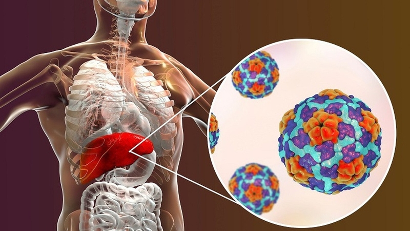 Triệu chứng viêm gan B giai đoạn đầu và hướng điều trị viêm gan B cấp tính 3