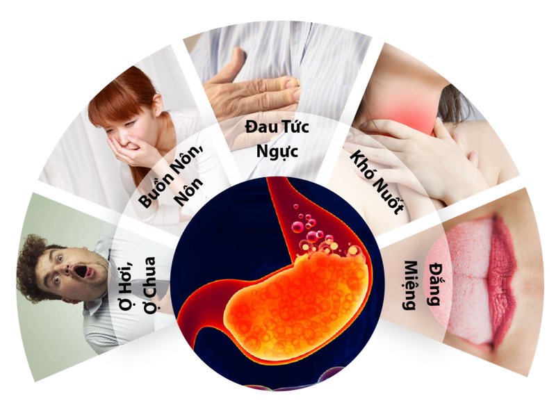 Tổng hợp các triệu chứng viêm hang vị dạ dày