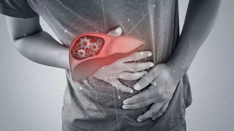 Triệu chứng xơ gan là gì? Cách phát hiện sớm bệnh xơ gan 4