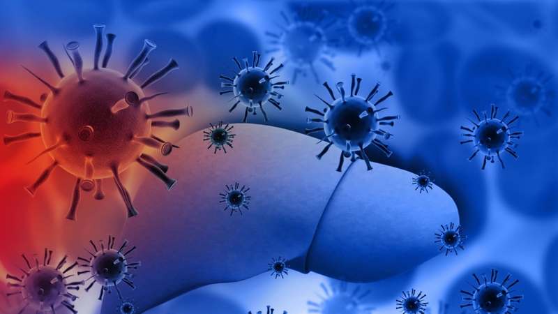 Triệu chứng xơ gan là gì? Cách phát hiện sớm bệnh xơ gan 5