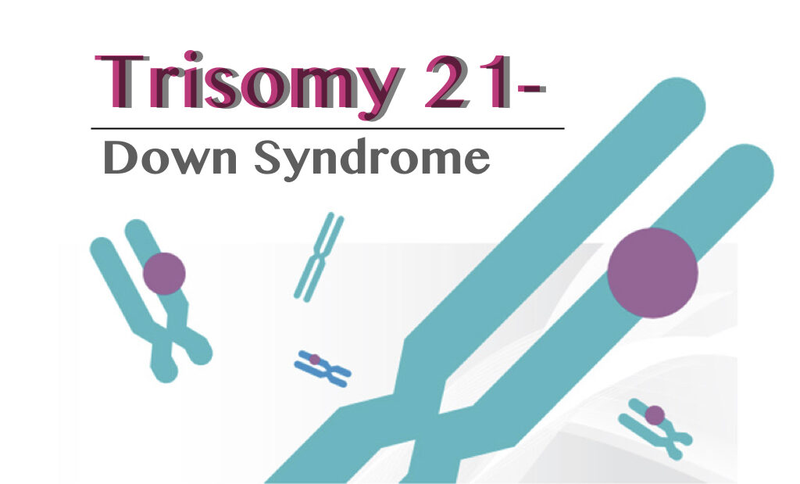 Trisomy 21 là gì? Kết quả chỉ số Trisomy 21 bao nhiêu là bình thường?3