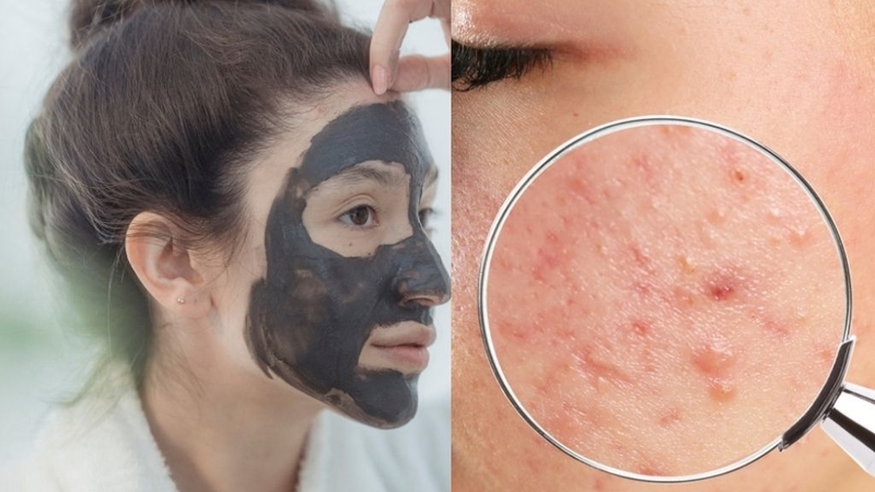 Tro núi lửa: Thành phần trong làm đẹp đang được quan tâm! 2