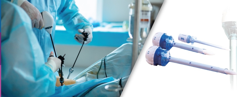 Trocar: Dụng cụ không thể thiếu trong phẫu thuật nội soi 3