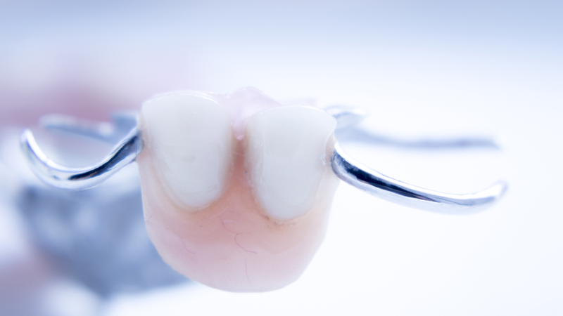 Trồng răng cửa có đau không? Những phương pháp trồng răng cửa phổ biến hiện nay 4