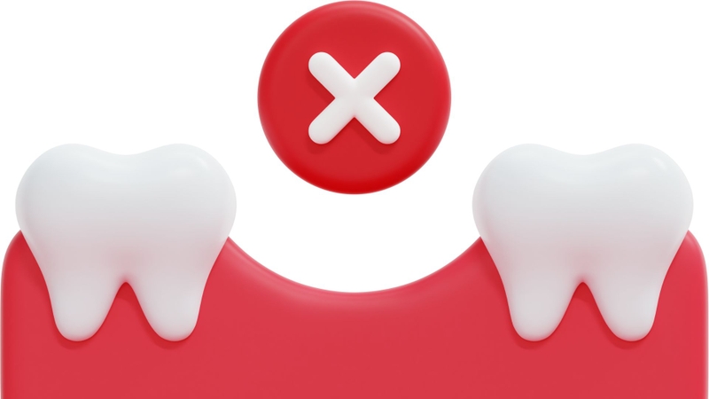 Trồng răng hàm số 6 giá bao nhiêu​? Nên trồng bằng phương pháp nào? 2