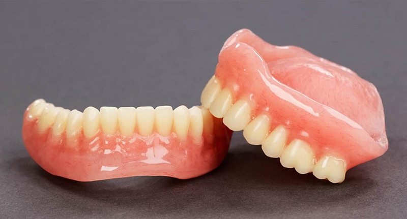 Lưu ý khi trồng răng ở người cao tuổi 2