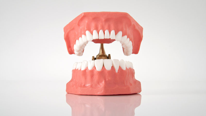 Trồng răng tháo lắp có ưu và nhược điểm gì?1