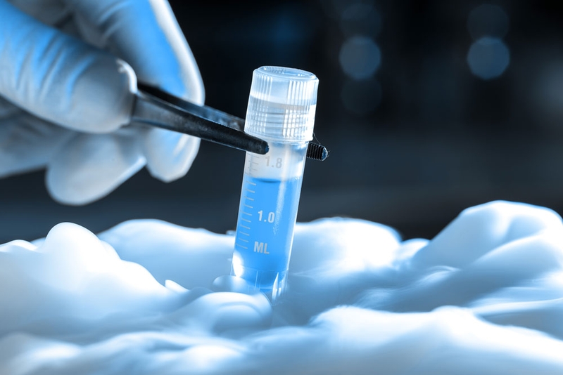 Trữ lạnh tinh trùng được thực hiện như thế nào? 3