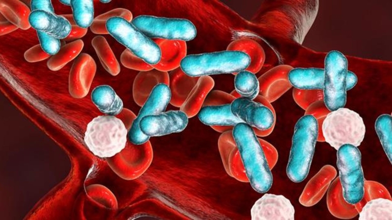 Trực khuẩn mủ xanh có thể là tác nhân gây nhiễm trùng huyết