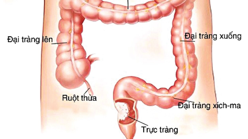 Trực tràng dài bao nhiêu cm trong ổ bụng? 1
