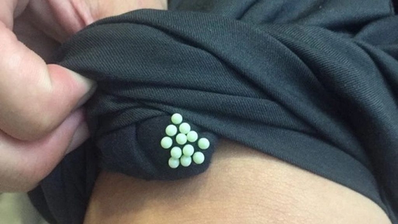 Trứng côn trùng trên quần áo: Nguyên nhân, cách khắc phục 2