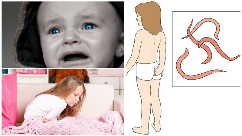 Trứng giun kim và những điều có thể bạn chưa biết 3