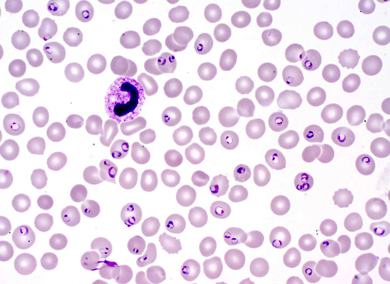 Trùng sốt rét có đặc điểm gì? 3 lưu ý phòng ngừa bệnh hiệu quả 1