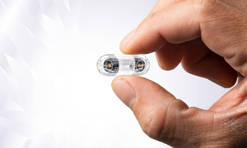 Trước khi nội soi dạ dày cần làm gì? Những phương pháp nội soi dạ dày hiện nay 3