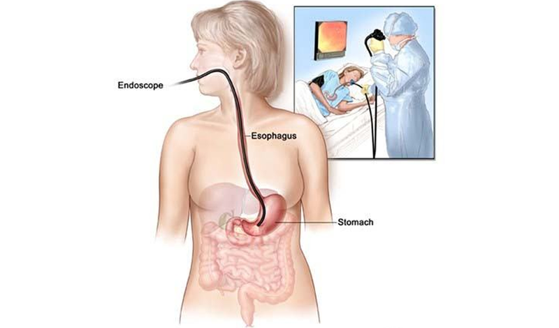 Truyền dinh dưỡng qua đường ruột