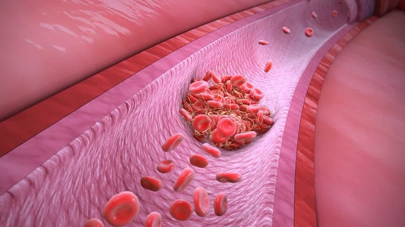 TS TC là gì? Hiểu rõ về các xét nghiệm đông máu trong chẩn đoán và điều trị bệnh 2