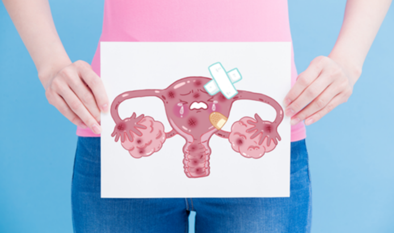 Tử cung lạnh là gì? Nguyên nhân và cách điều trị tử cung lạnh 1