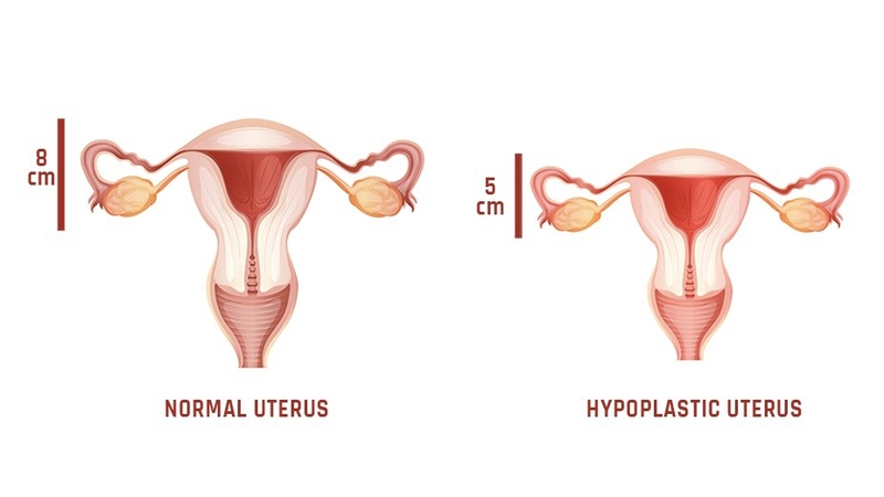 tu-cung-nho-nguyen-nhan-va-nhung-dau-hieu-nhan-biet 2