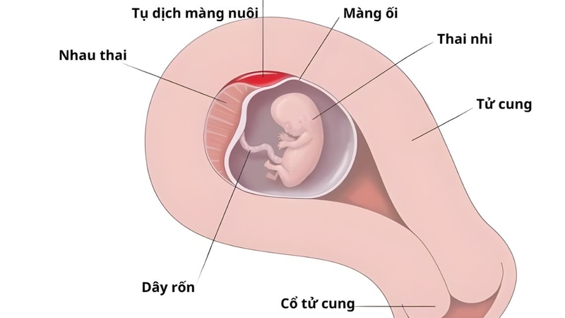 Tình trạng tụ dịch màng nuôi cần được theo dõi sát