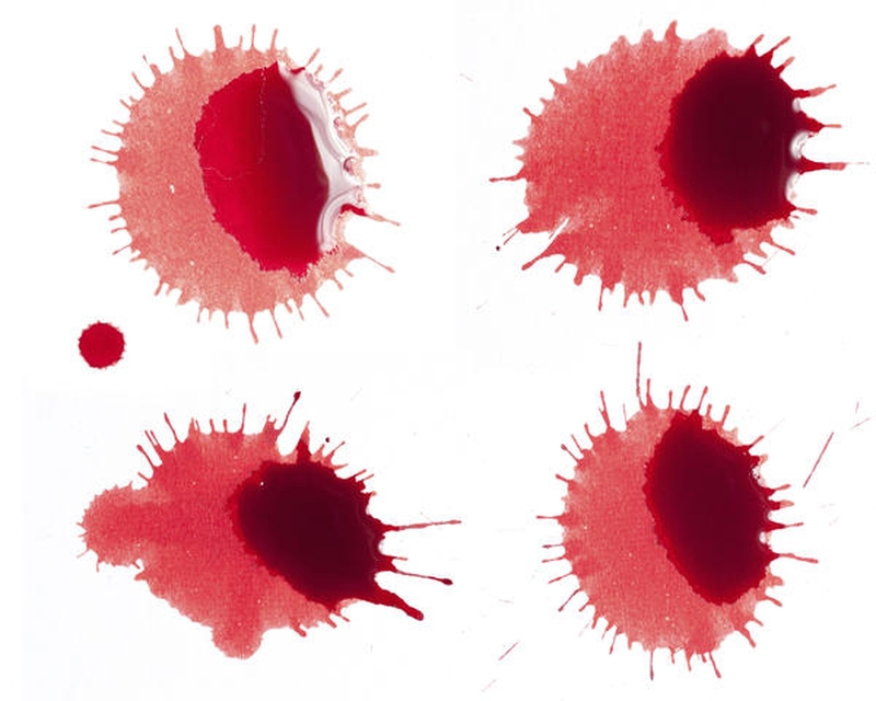 Tụ dịch màng nuôi: Nguyên nhân và cách điều trị 2