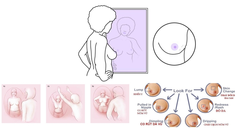 Tự khám phát hiện sớm dấu hiệu ung thư v1 2